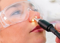 Burun Tıkanıklığı Nasıl Geçer Burun Tıkanıklığı Nasıl Geçer