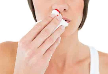 Burun Kanaması Tampon Nasıl Yapılır? Burun Kanaması Tampon Nasıl Yapılır?